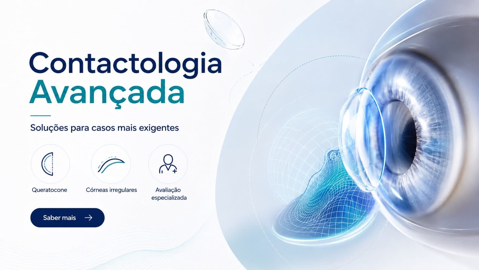 Contactologia avançada na OPTICLINIC